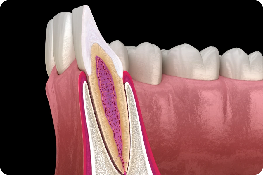 Traitements endodontiques au cabinet dentaire des Drs Serror de Marolles en Hurepoix (91630)