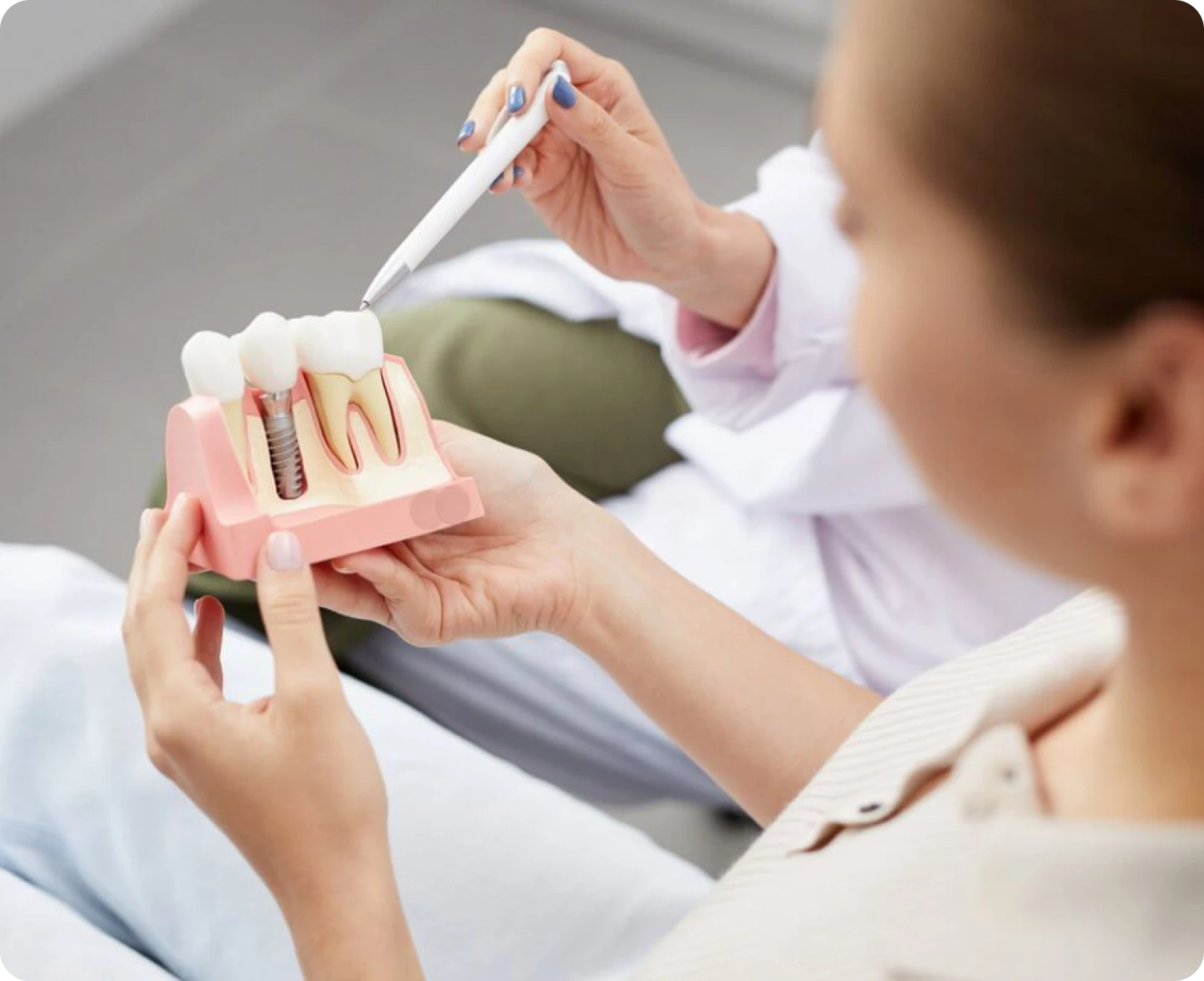 Implantologie au cabinet dentaire de Marolles en Hurepoix (91630)