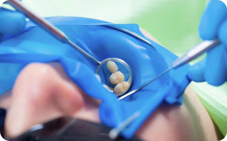 Digue dentaire au cabinet dentaire des Drs Serror à Marolles en Hurepoix