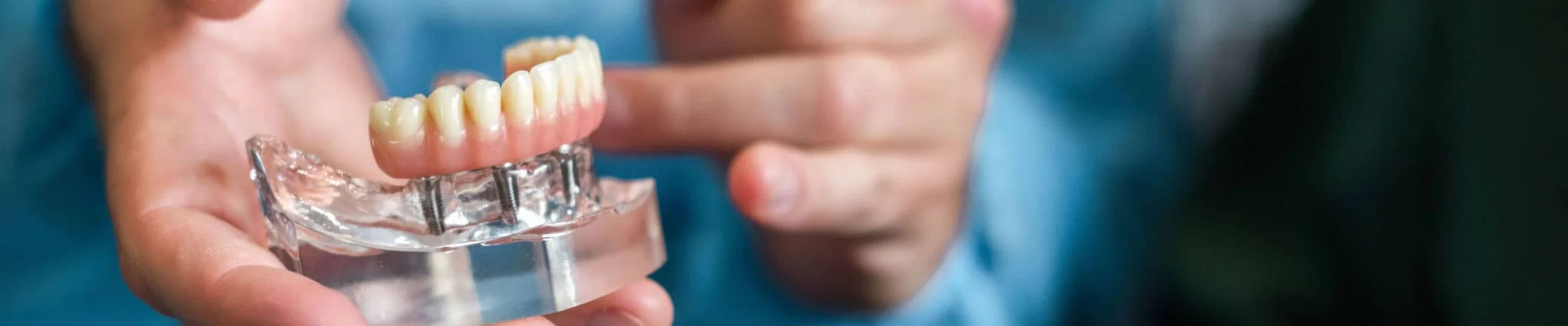 Prothèse dentaire près de Cheptainville