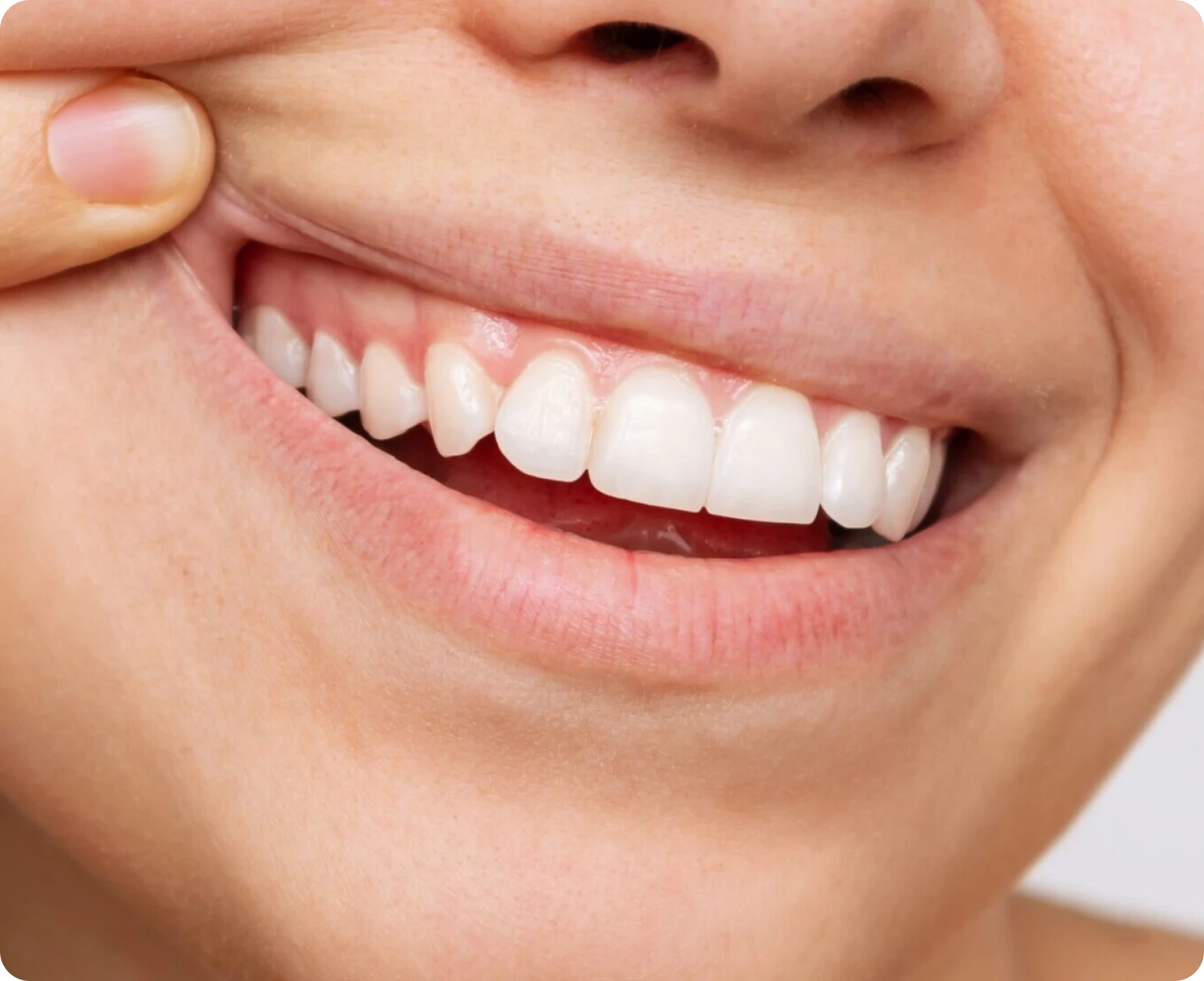 Traitements parodontologie au cabinet dentaire des Drs Serror de Marolles en Hurepoix (91630)